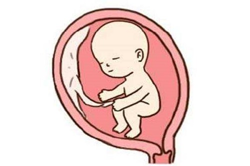 赴泰试管婴儿如何为精索静脉曲张不育者搭建生育桥梁？