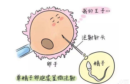 不孕贴士：美国试管婴儿也要趁早!