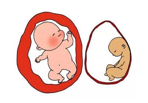 输卵管堵塞有积水能做试管婴儿吗？如何治疗？